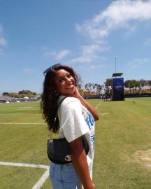 Cowboys Cheerleader Dances Without Wig After Revealing Alopecia Diagnosis
