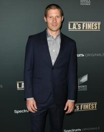 Zach Gilford Shares Shocking Photos of Face After Health Scare