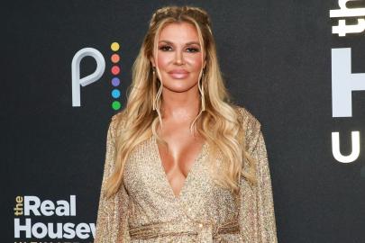 Brandi Glanville Hasn’t Slept With Anyone in a Year Due to Facial Deformity
