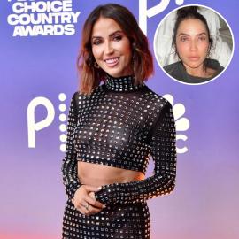 'Bachelorette' Star Kaitlyn Bristowe's Quotes About Plastic Surgery