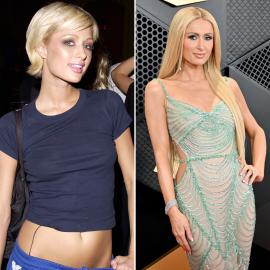 Has Paris Hilton Had Plastic Surgery? Transformation Photos and Quotes