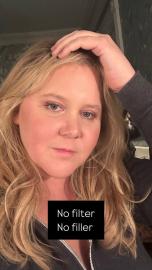 Amy Schumer Shares Fresh-Faced Selfie With ‘No Filter’ and ‘No Filler’