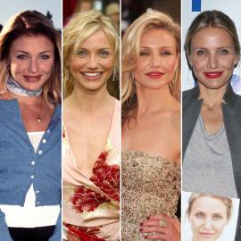 Has Cameron Diaz Had Plastic Surgery? Her Transformation Photos