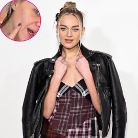 Kelsea Ballerini Gets Real About a Stress Break Out Before Hitting the Stage