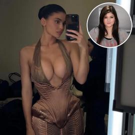 Kylie Jenner's Plastic Surgery Transformation: Before and After Photos