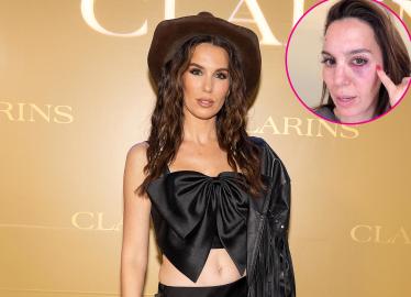 Christy Carlson Romano Says She Was 'Shot in the Eye' on Husband's Birthday