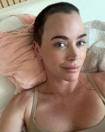 Teddi Mellencamp Says She's 'Ready for Radiation' After Brain Surgery