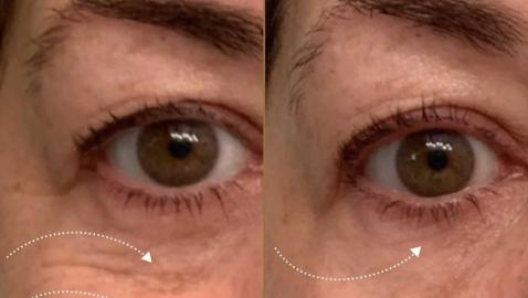 This Eye Cream Works Like 'Magic' for Shoppers in Their 40s