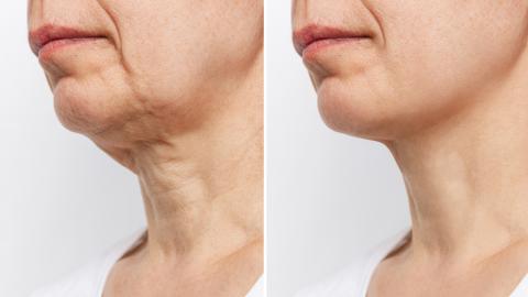 This Esthetician-Approved Cream Helps Women 40+ Firm Crepey Skin — No Office Visit Needed