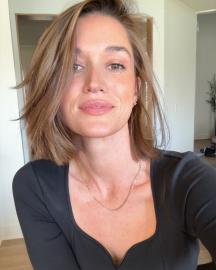 Bachelor Nation Alum Jade Roper Says She Has Benign Pilar Cyst on Her Scalp