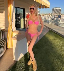Brandi Glanville Gets Real About Her Sex Life Amid Facial Disfiguration