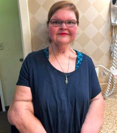 1000-lb Sisters’ Tammy Slaton Steps Out After Skin Removal Surgery