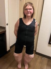 Tammy Slaton Wears Shapewear After Weight Loss, Skin Removal Surgeries