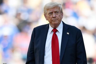 Donald Trump Diagnosed With 'Common' Vein Condition After Leg Swelling
