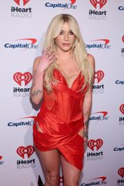 Kesha Thanks ‘Salmon Sperm’ for Her Flawless Skin