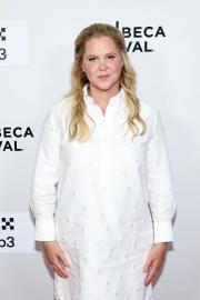Amy Schumer Undergoes Back Surgery After ‘Back in the Day’ Surfing Injury