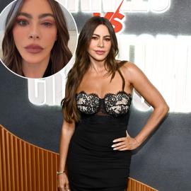 Sofia Vergara Missed the Emmys Due to Eye Allergy, Had to Go to ER