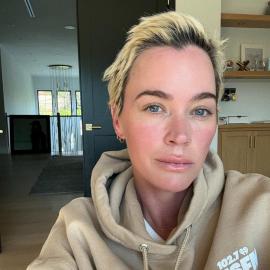 Teddi Mellencamp Shows Hair Growth Progress With Cancer Battle Update