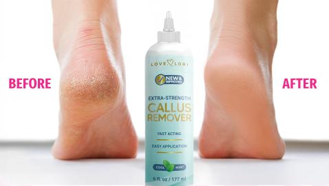 This Salon-Quality Callus Remover Dissolves Thick Dead Skin — On Sale for $9