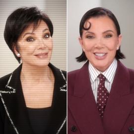 'The Kardashians' Season 7 Shows Before and After of Kris Jenner's Facelift