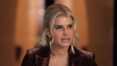 Jessica Simpson's 'All's Fair' Character Undergoes Botched Plastic Surgery